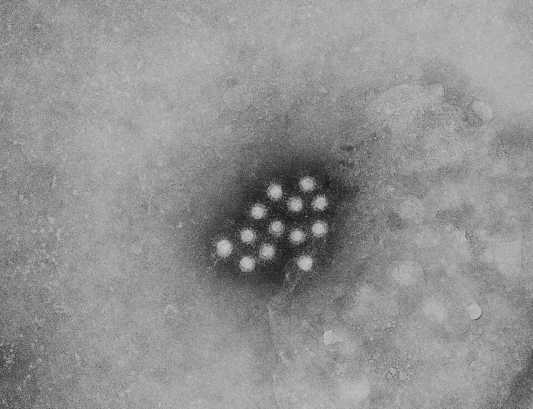 Imagem de referência de hepatite C, descrito nos dados abertos como doença Viral