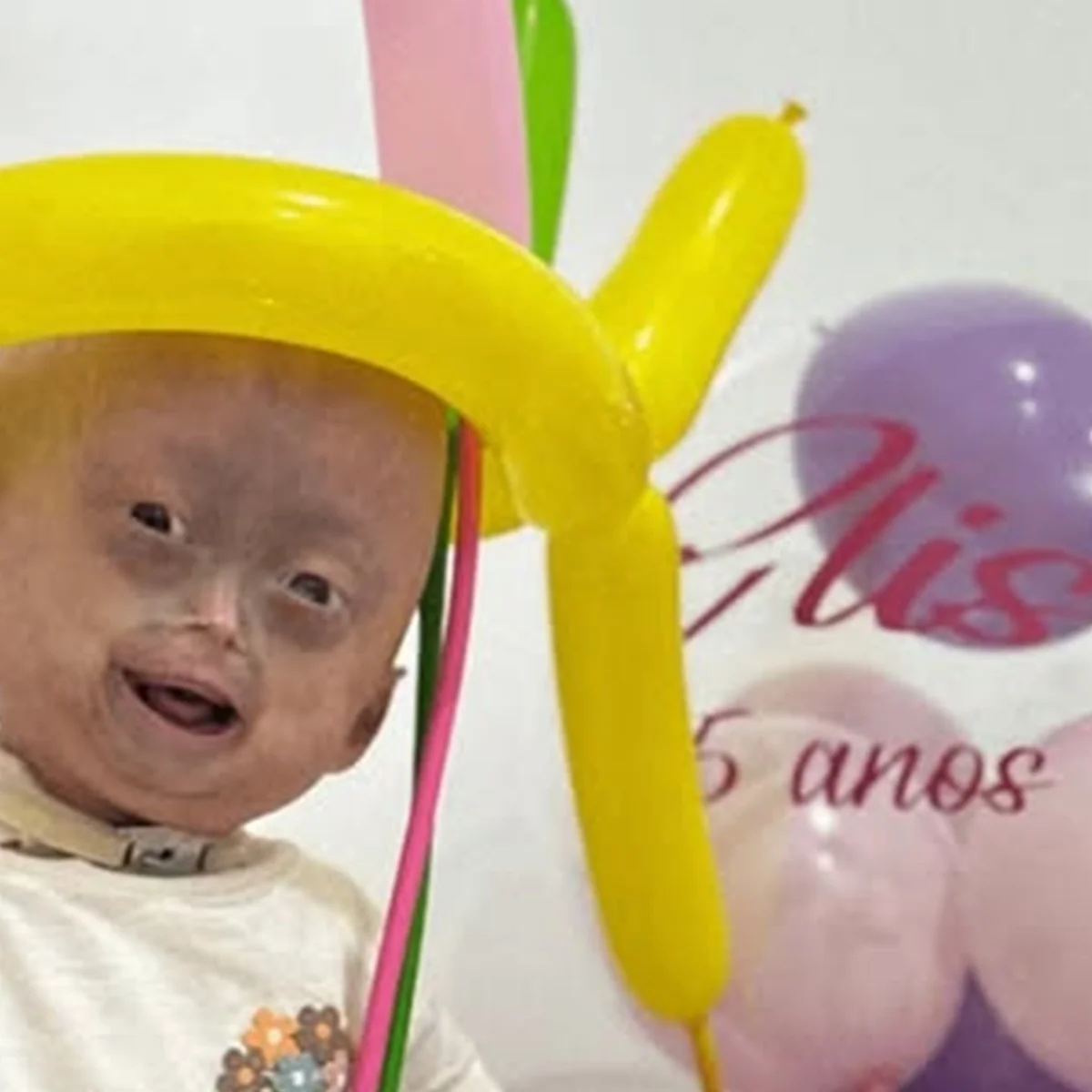 Mãe de Elis, influencer mirim com síndrome rara, lamenta a morte. Veja
