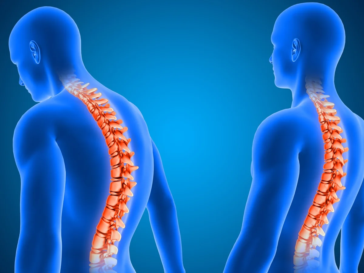 Médicos afirmam ter feito primeiro transplante de medula espinhal na Rússia