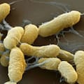 “Yersinia pestis integra la categoría A de agentes de bioterrorismo”, afirma un infectólogo